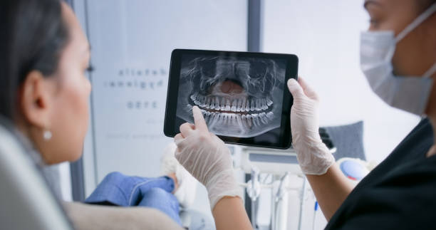 Licensed Dental Implants service in Humble, TX - Smile Center Dentistry