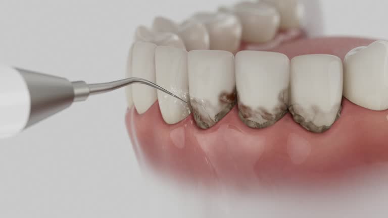 Reliable Dental Implants contractor in Humble, TX by Smile Center Dentistry